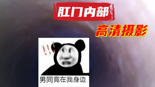 超清摄像头拍摄肛门内部C全过程[218M]